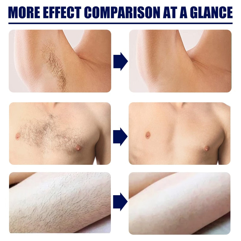 Professional Painless Men Beard Hair Removal Cream