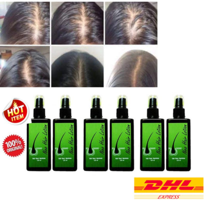 15 Pieces Neo Hair Lotion 120ml Anti Hair Loss Hair Thailand Bangkok