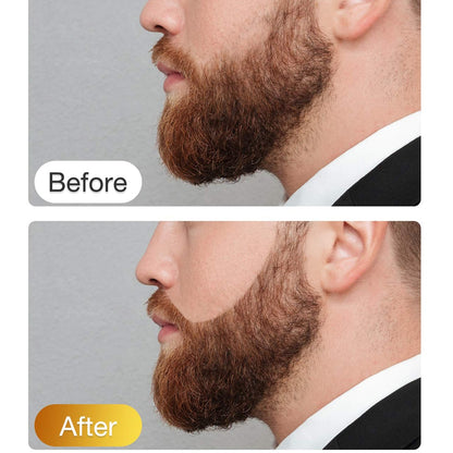 Repair Professional Men Beard Growth Pen Filler