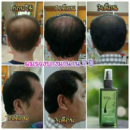 120ml Neo Hair Lotion Hair Root HAIR BEARD SIDEBURNS