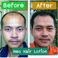 120ml Neo Hair Lotion Hair Root HAIR BEARD SIDEBURNS