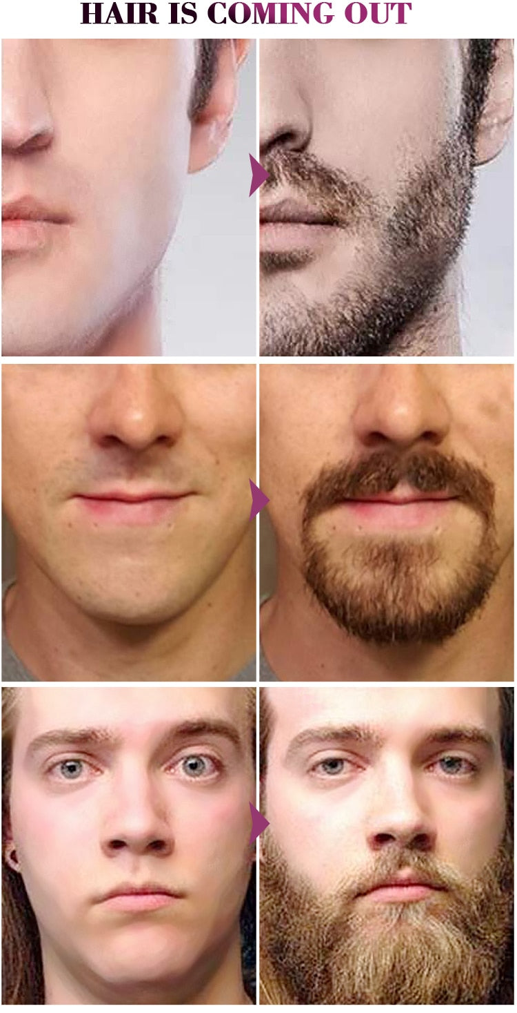 Men Beard Moustache Essential Oil Fast Growt