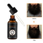 Beard Growth Kit for Facial Hair Growth Moisturizing