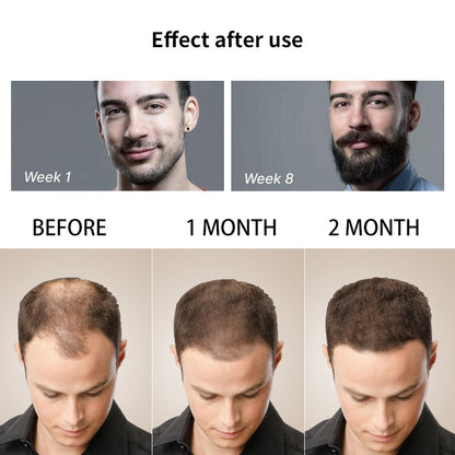 Beard Growth Kit Men