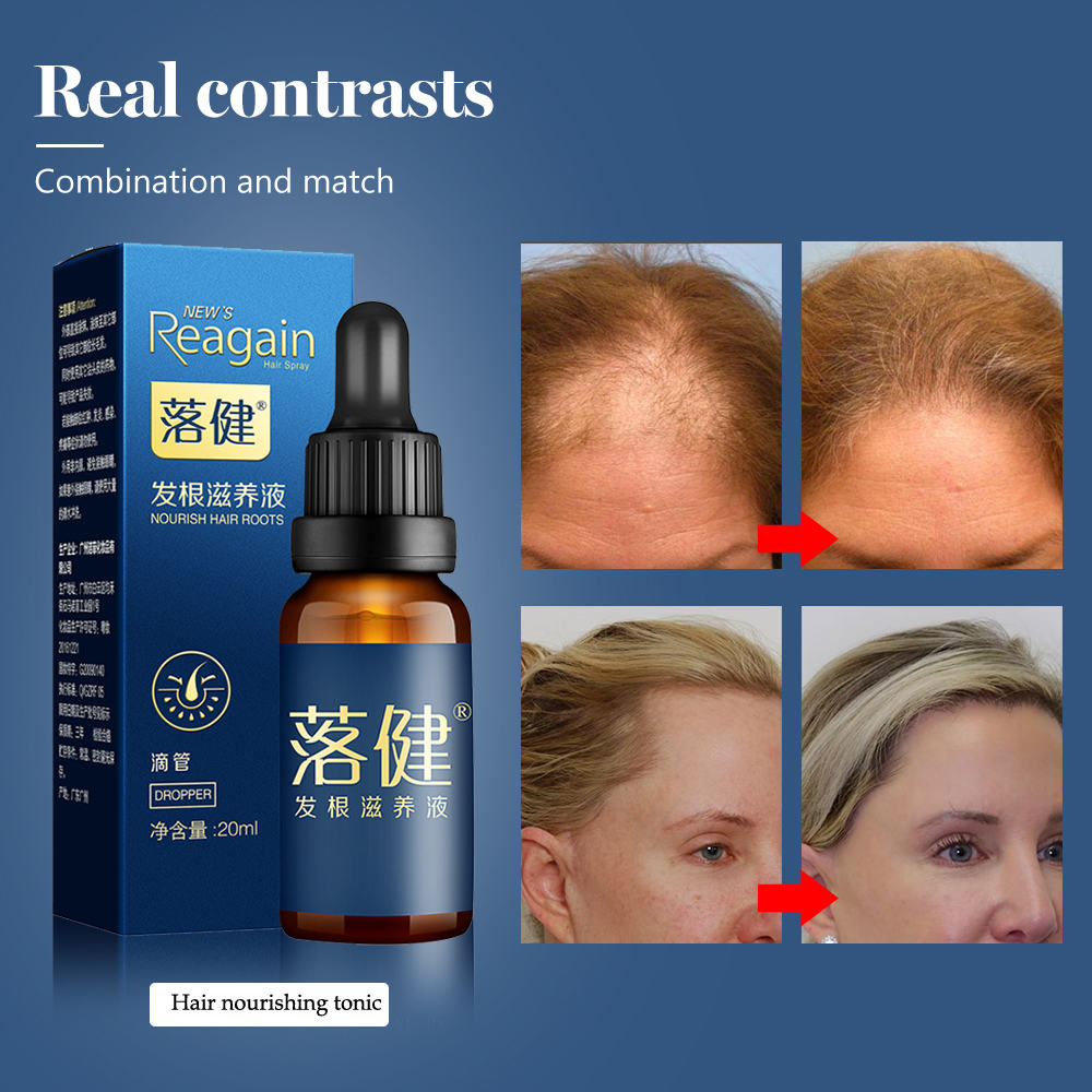 Hair Loss Treatment Hair/Beard Growth Oil Hair Care