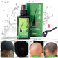 5 Pices Neo Hair Lotion Thailand  Paradise Hair Treatment Hair Root Anti-Loss