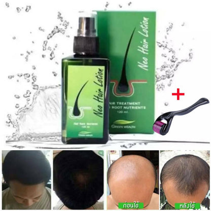 5 Pieces Neo Hair Lotion Thailand  Paradise Hair Treatment Hair Root Anti-Loss