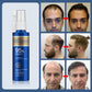 Hair Growth Oil Treatment Anti Hair Loss Men Beard Repair Damage Hair Roots