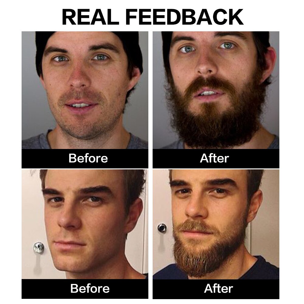 Effective Beard Growth Oil Thicken More Full Hair