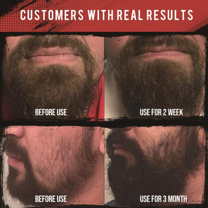 Beard Care Set Beard Growth Cream Oil Serum