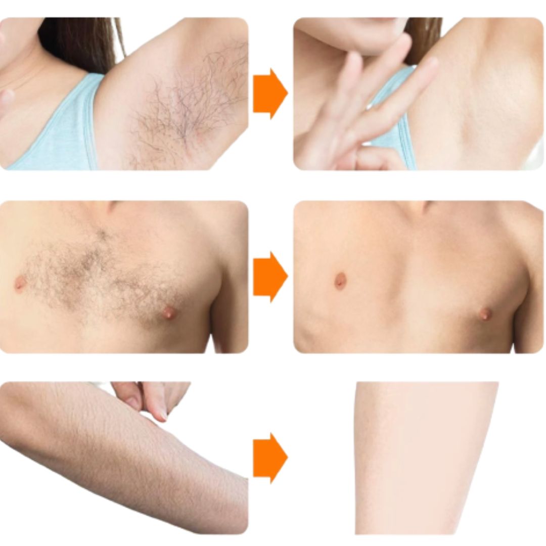 Hair Removal Gentle Spray Body Care For Beard Armpits Chest and Legs