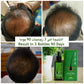 4 pieces Neo Hair Lotion 120ml Hair Treatment Hair