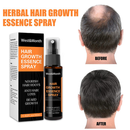 Natural Men Beard Growth Essence Spray Hair Loss