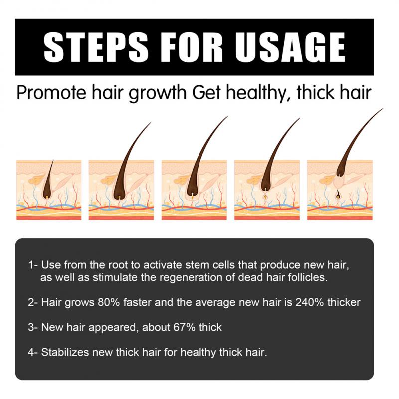 Best Seller Men Hair Beard Growth Derma Roller Hair Loss Treatment