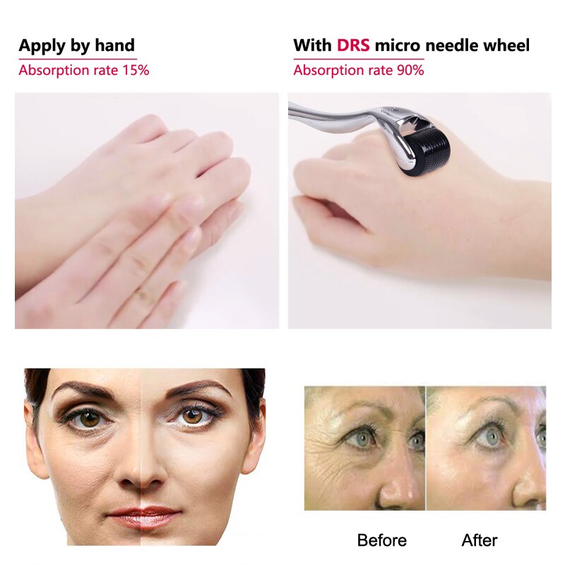 Micro Needle 540 Roller Derma Hair Regrowth