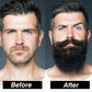Men Beard Growth Kit Hair Growth Enhancer