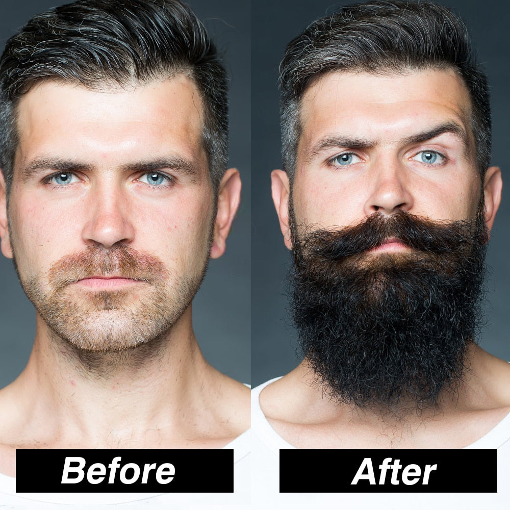 Men Beard Growth Kit Hair Growth Enhancer