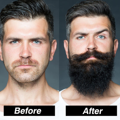 Special Offer Men Beard Growth Kit Hair Growth Enhancer