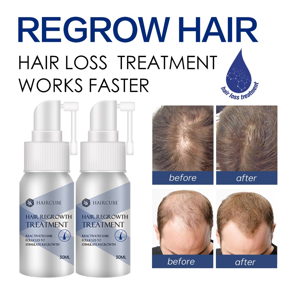 Hair Regrowth Spray Natural Herbal Rapid Serum
