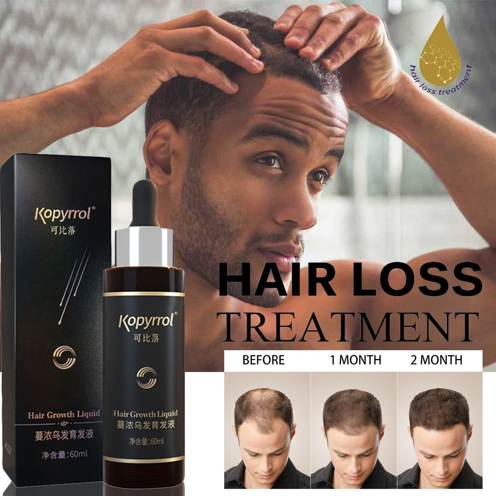 Hair Loss Treatment Hair/Beard Growth Oil Hair Care