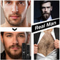 Best Seller Beard Growth Kit The Men Care Needle Roller