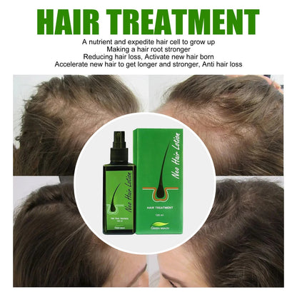 120ml Neo Hair Lotion Serum Essence Anti Hair Loss Special Offer