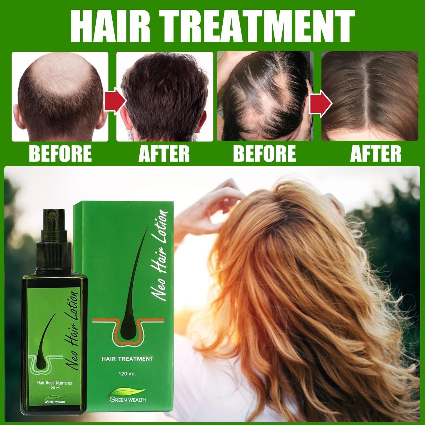 120ml Neo Hair Lotion Serum Essence Anti Hair Loss