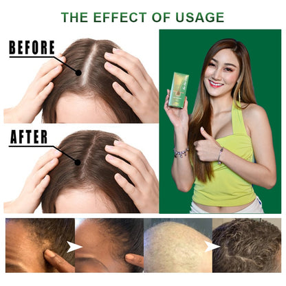 Hair Lotion Bangkok Spray for Hair growth Stop Loss