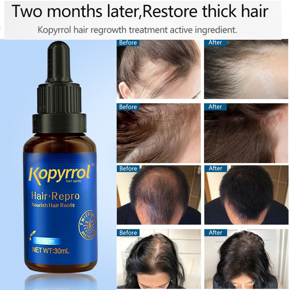 Natural Hair Growth Essential Oil Repairing Thicken Hair