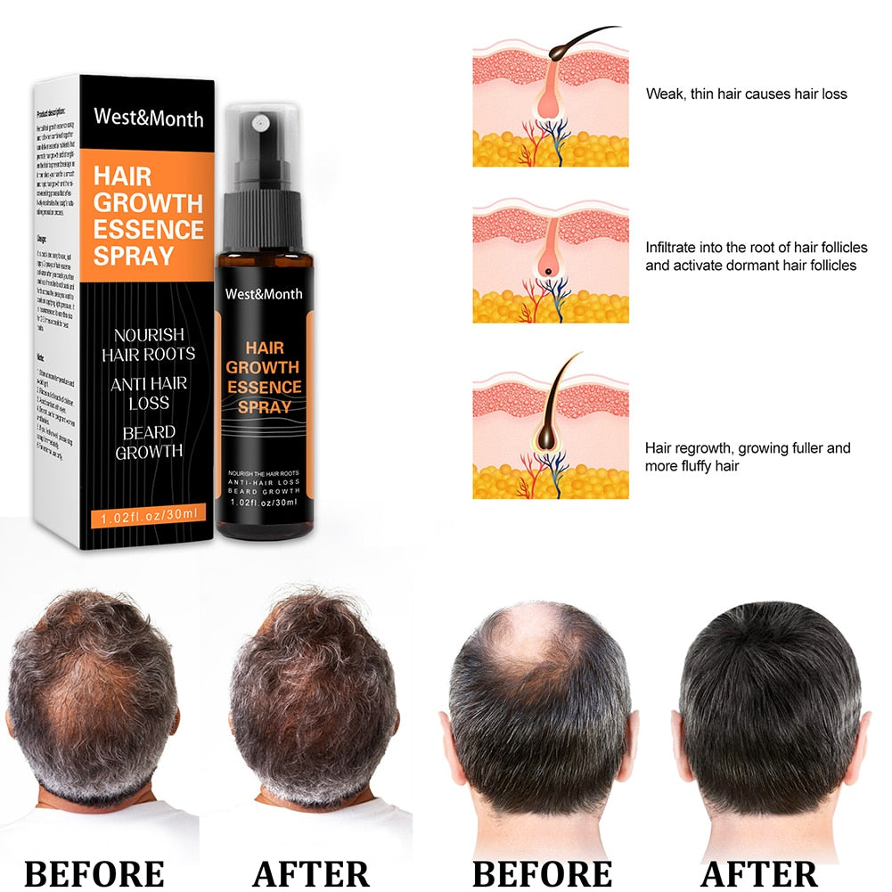 Natural Men Beard Growth Essence Spray Hair Loss