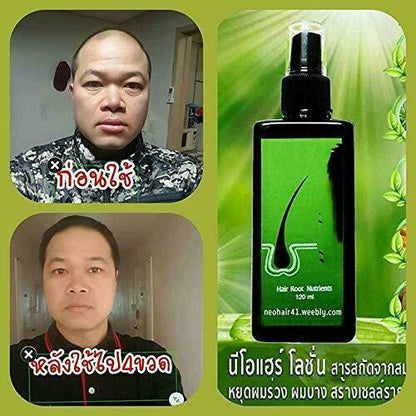 Neo Hair Lotion Hair Growth Repairing And Nourishing Essence