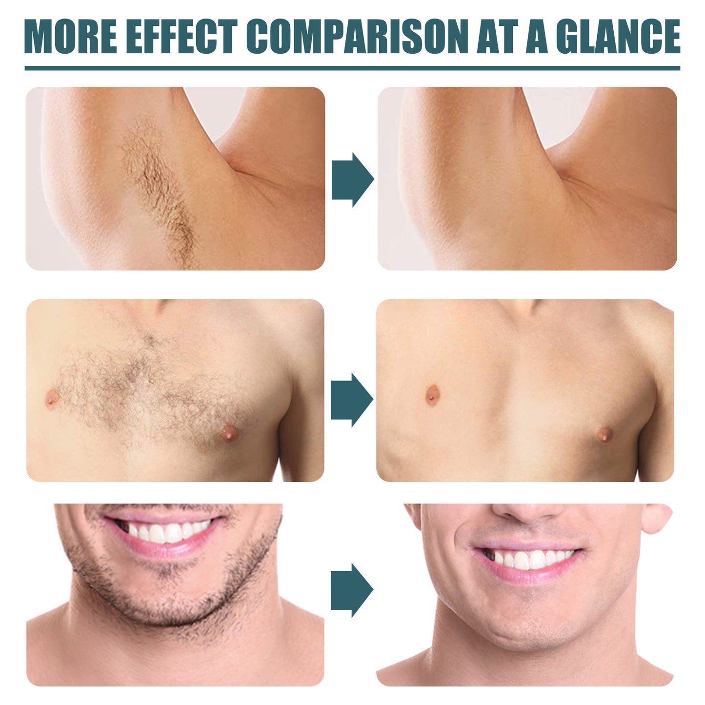 Best seller EELHOE Men Beard Removal Cream Is Clean And Gentle