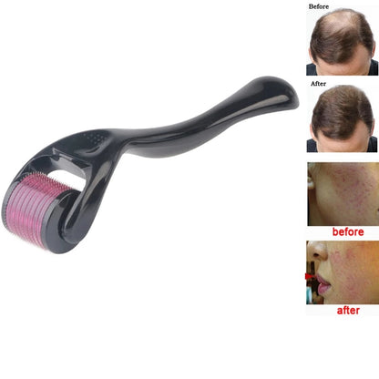 Hair Regrowth Beard Growth Anti Hair Loss 540 Roller Derma Roller